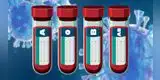 COVID-19: personas de sangre O pueden tener menor riesgo de infección