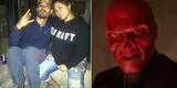 Joven se amputa la nariz para parecerse a 'Red Skull' y así luce ahora [FOTOS Y VIDEO]