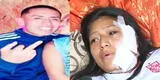 Intento de feminicidio: Condenan a 15 años de cárcel a sujeto que desfiguró a pareja