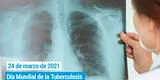 Día de la Tuberculosis 2021: TBC causa la muerte diaria de casi 4 mil personas en el mundo [VIDEO]