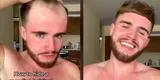 Jover tiktoker sorprende con truco para detener un retroceso de la línea de cabello [VIDEO]