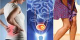 Salud: cuatro recomendaciones básicas para prevenir el cáncer de vejiga