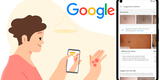 Google presenta aplicación que promete identificar afecciones dermatológicas, a través de la cámara del celular