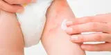 Dermatitis del pañal: ¿Qué es y cómo curarla?