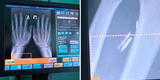 Médico ruso se implanta cinco microchips en el cuerpo para hacer su vida “más fácil”