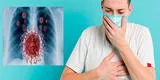 COVID-19 y la tuberculosis: Cosas que tiene en común y no sabías
