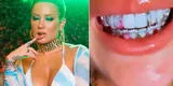 Leslie Shaw revela que los diamantes en su dentadura habrían costado 15 mil dólares [VIDEO]