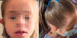 Indignación por profesora que amarró una mascarilla en la cabeza de una niña son síndrome de Down