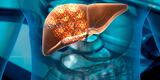 ¿Qué examen se hace para detectar cáncer de hígado?