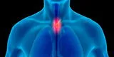 Cuáles son los síntomas del cáncer de esófago en la etapa inicial