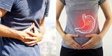 Cáncer de estómago: Así puedes reconocer los síntomas en la etapa inicial
