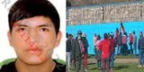 Ayacucho: dictan prisión para sujeto que mató a su pareja en Año Nuevo