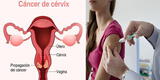 ¿Cuáles son los síntomas del cáncer cervical en la etapa inicial?