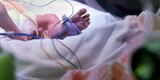 Loreto: Diresa confirma fallecimiento de una bebé de 3 meses por COVID-19