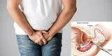 Cáncer de próstata: ¿Cómo saber qué órganos están siendo afectados?