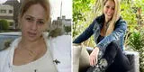 Melissa Klug luce irreconocible a sus 37 años: El antes y el después de la chalaca