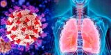 Ómicron: ¿Cuáles son las secuelas que tendrían mis pulmones?
