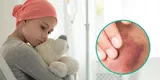 7 síntomas de la leucemia en niños que debes reconocer