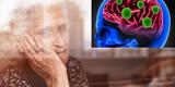 COVID-19: esta es la secuela similar al Alzheimer que puedes tener si sufriste un cuadro grave