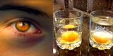 Mal del ojo: Cuáles son los significados que hay después de una limpia con huevo