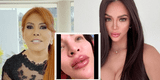 Magaly Medina habla acerca de los labios de Sheyla Rojas: "Parece deformado" [VIDEO]