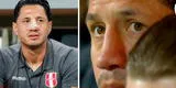 Gianluca Lapadula luce nariz respingada para jugar por Perú: se sometió a un tratamiento especial