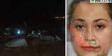 Callao: mujer fue hallada sin vida a orillas de la playa Carpayo con signos de haber sido golpeada