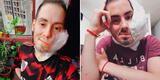 “Ya no sufre más”: Murió Sebastián Amurín, el joven de 25 años que tenía un tumor en el rostro