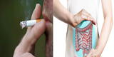 ¿Por qué el cáncer de colon es un riesgo para los fumadores?