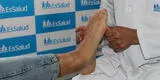 EsSalud recomienda tratar a tiempo el pie plano para evitar problemas en la rodilla, cadera y columna