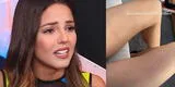 Luciana Fuster fue atacada por perritos de Patricio Parodi: "Nunca confíen en un Chihuahua" [VIDEO]