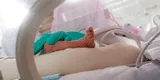 Un niño de 2 años que nació con dos penes en Brasil fue operado y le quitaron el más grande