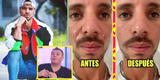 Anthony Aranda se sometió a "retoquitos", según especialista: "Se cambió la cara" [VIDEO]