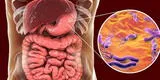 Helicobacter Pylori: cuáles son los síntomas de la bacteria causante del cáncer