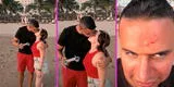 Intenta grabar apasionado beso con su novia, pero dron se estrella en su cara: “Beso de tres” [VIDEO]