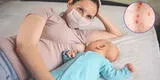Viruela del mono: ¿puedo seguir con la lactancia a mi bebé si me contagio?