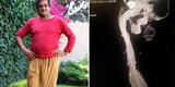 Roberto Esquivel: el hombre con el pene más largo del mundo sufre problemas de salud por su condición