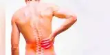 Lumbalgia: ¿Qué es, cuántos tipos existen y cuáles son los tratamientos?