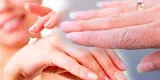 ¿Por qué se pelan las manos y las yemas de los dedos?