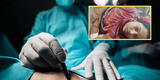 Mujer de 48 años es operada de urgencia y le roban los riñones: pide órganos del médico implicado