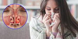 ¿Cuánto tiempo puede durar una congestión nasal?