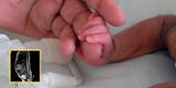 Nace una bebé con cola de casi 6 centímetros de largo en México [FOTOS]