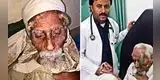 Hombre “más viejo del mundo” muere en operación para extirparle los cuernos