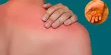 ¿Qué hacer ante la ola de calor y cómo evitar quemaduras en la piel?