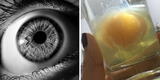Mal del ojo: conoce cómo interpretar las imágenes luego de una limpia con huevo
