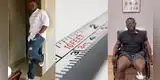 Hombre pasó por una cirugía para alargar sus piernas y así conseguir citas con mujeres