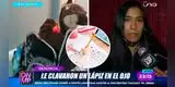 Niño de 6 años le clavó un lápiz en el ojo a su compañero de salón: el menor perdió la vista