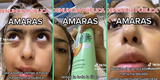 Joven peruana hace explosiva queja a la marca de shampoo ‘Amarás’: “Se me cae el cabello y sale caspa”