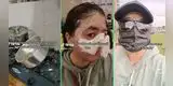 Joven sufre accidente con olla a presión y su experiencia es viral: "Me quemé la mitad de la cara"