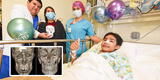 Menor que fue asaltado y le fracturaron 22 veces el rostro vuelve a sonreír tras operación en el INSN San Borja